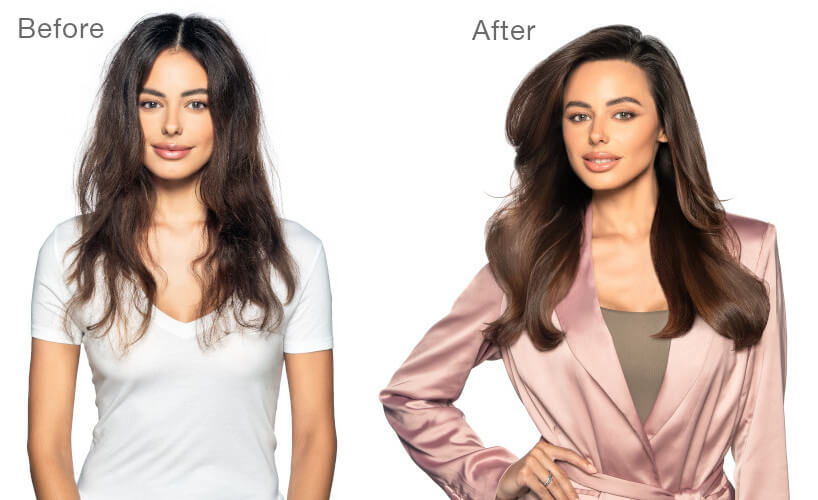 kbond20-before and after treatment model